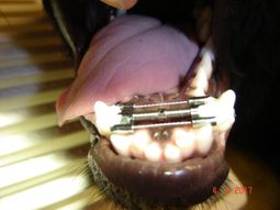 Zahnstellungskorrektur